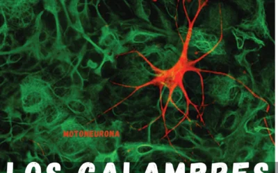 Los calambres musculares: causas y cómo evitarlos.